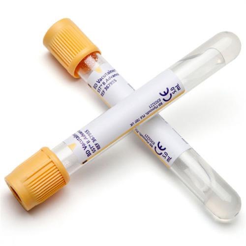 Gold-Top Serum Separator Tube (SST) - Image 2