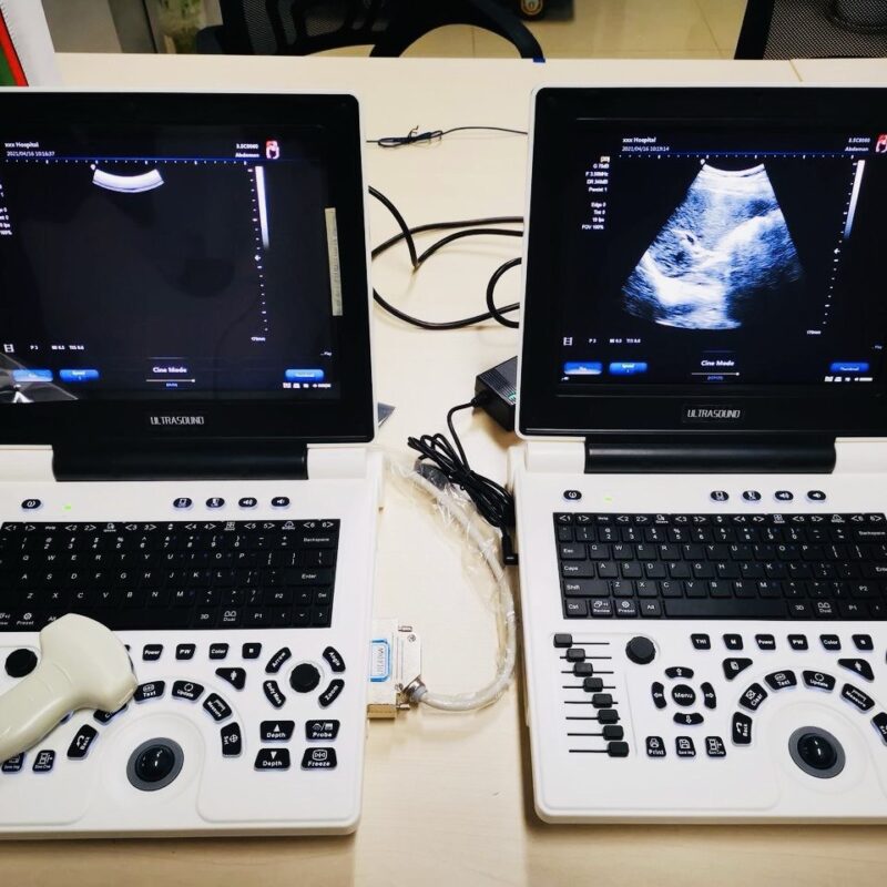 Portable Ultrasound Machine