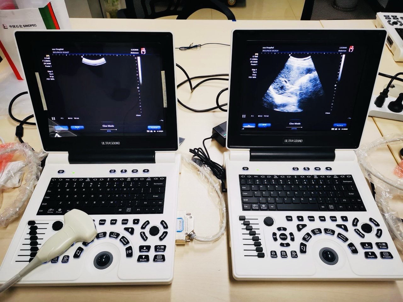 Portable Ultrasound Machine