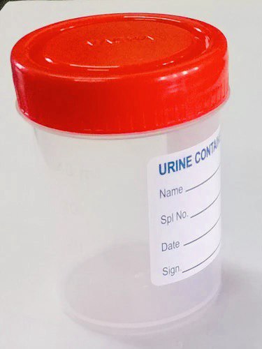Urine Container 60ml - Image 3